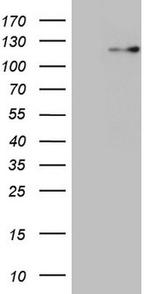 RNF20 Antibody in Western Blot (WB)