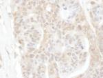 ROC1 Antibody in Immunohistochemistry (IHC)