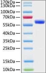 SARS-CoV-2 Spike Protein (RBD) (aa319-541), mFc Tag Protein in SDS-PAGE (SDS-PAGE)