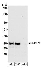 RPL29/Ribosomal Protein L29 Antibody in Western Blot (WB)
