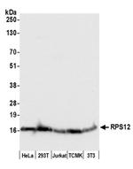 RPS12/Ribosomal Protein S12 Antibody in Western Blot (WB)