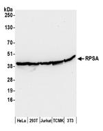 RPSA Antibody in Western Blot (WB)