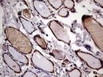 RRBP1 Antibody in Immunohistochemistry (Paraffin) (IHC (P))