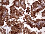 RRBP1 Antibody in Immunohistochemistry (Paraffin) (IHC (P))