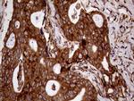 RRBP1 Antibody in Immunohistochemistry (Paraffin) (IHC (P))