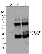 Rabbit IgG (H+L) Cross-Adsorbed Secondary Antibody in Immunoprecipitation (IP)