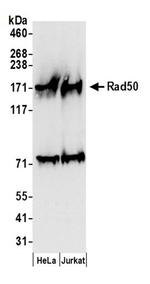 Rad50 Antibody in Western Blot (WB)