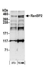 RanBP2 Antibody in Western Blot (WB)