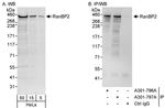 RanBP2 Antibody in Western Blot (WB)
