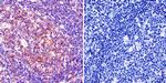 Pan Ras Antibody in Immunohistochemistry (Paraffin) (IHC (P))