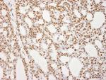 RecQ1 Antibody in Immunohistochemistry (IHC)