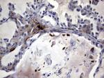 S100A9 Antibody in Immunohistochemistry (Paraffin) (IHC (P))