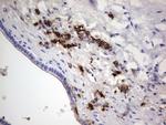 S100A9 Antibody in Immunohistochemistry (Paraffin) (IHC (P))