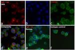 Human IgG (H+L) Cross-Adsorbed Secondary Antibody in Immunocytochemistry (ICC/IF)