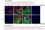 Human IgG (H+L) Cross-Adsorbed Secondary Antibody