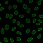 Rabbit IgG Nano (VHH) Secondary Antibody in Immunocytochemistry (ICC/IF)