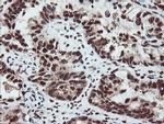 SAMHD1 Antibody in Immunohistochemistry (Paraffin) (IHC (P))