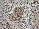 SAMHD1 Antibody in Immunohistochemistry (Paraffin) (IHC (P))