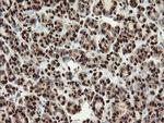 SAMHD1 Antibody in Immunohistochemistry (Paraffin) (IHC (P))