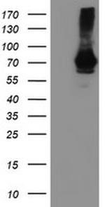 SAMHD1 Antibody in Western Blot (WB)