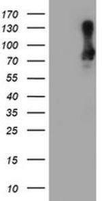 SAMHD1 Antibody in Western Blot (WB)