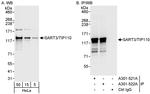 SART3/TIP110 Antibody in Western Blot (WB)