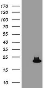 SAT2 Antibody in Western Blot (WB)