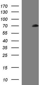 SCP2 Antibody in Western Blot (WB)