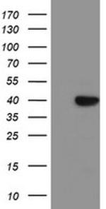 SDS Antibody in Western Blot (WB)