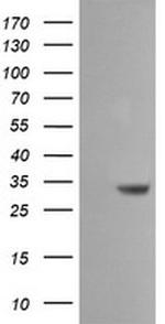 SDSL Antibody in Western Blot (WB)