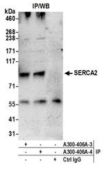 SERCA2 Antibody in Western Blot (WB)