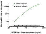 SERPINA1 Antibody in Luminex (LUM)