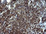 SERPINB3 Antibody in Immunohistochemistry (Paraffin) (IHC (P))