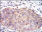 PAI1 Antibody in Immunohistochemistry (Paraffin) (IHC (P))