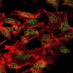 SETDB1 Antibody in Immunocytochemistry (ICC/IF)