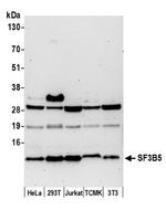 SF3B5 Antibody in Western Blot (WB)