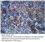 SHC Antibody in Immunohistochemistry (IHC)