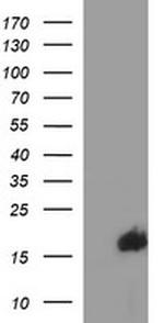 SIVA1 Antibody in Western Blot (WB)