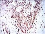 SKP1 Antibody in Immunohistochemistry (Paraffin) (IHC (P))