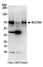 SLC1A4/ASCT1 Antibody in Western Blot (WB)