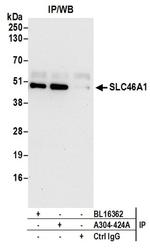 SLC46A1 Antibody in Western Blot (WB)