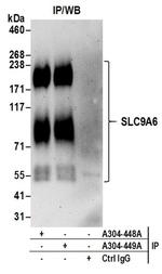 SLC9A6 Antibody in Western Blot (WB)