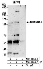 SMARCA1/SNF2L Antibody in Immunoprecipitation (IP)