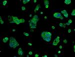 SORD Antibody in Immunocytochemistry (ICC/IF)