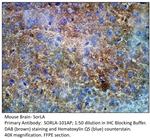 SorLA Antibody in Immunohistochemistry (IHC)