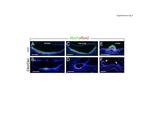 SOX2 Antibody in Immunohistochemistry (IHC)