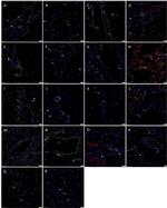 SOX2 Antibody in Immunohistochemistry (IHC)