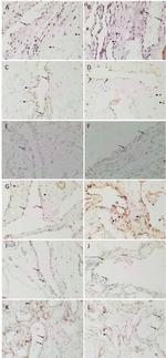 SOX2 Antibody in Immunohistochemistry (IHC)