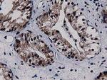 SQSTM1 Antibody in Immunohistochemistry (Paraffin) (IHC (P))