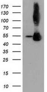 SQSTM1 Antibody in Western Blot (WB)